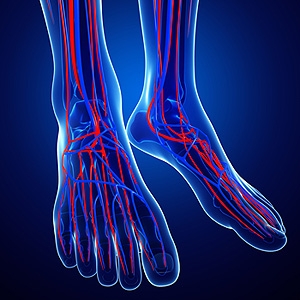 Can Airplane Travel Affect Circulation?