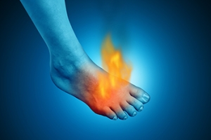 Reasons for Burning Foot Pain