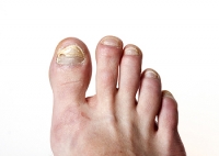 How Changes in Your Feet Can Indicate Problems Elsewhere