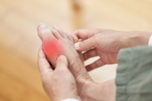 Easing the Agony of Gout in the Foot