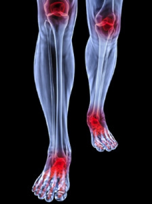 Possible Treatments for Rheumatoid Arthritis