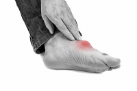 How to Check If You Have a Bunion