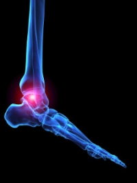 Painful Joint Pain in the Feet